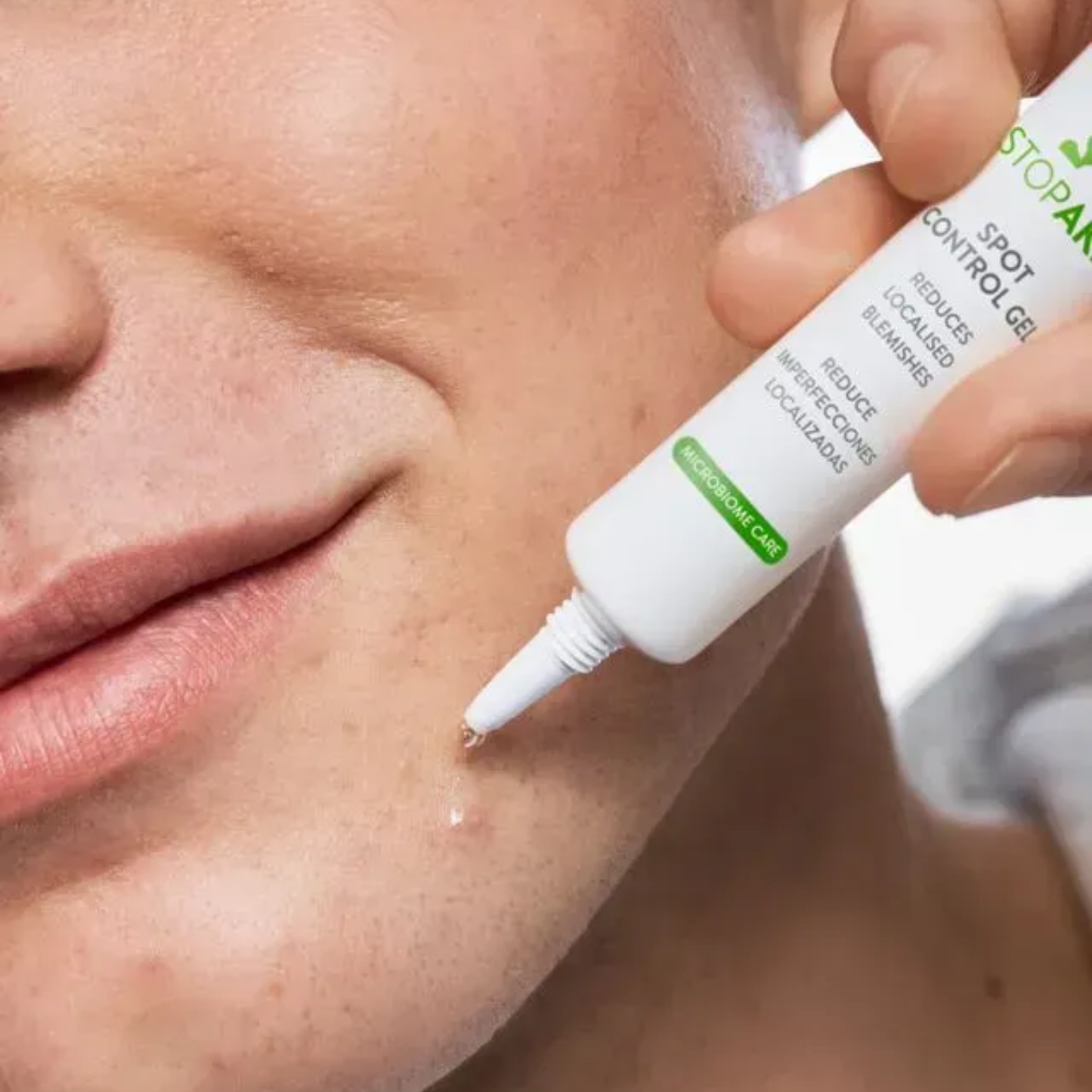 Гель інтенсивний проти акне локального застосуванн STOP AKN microbiome friendly BABE 10 мл